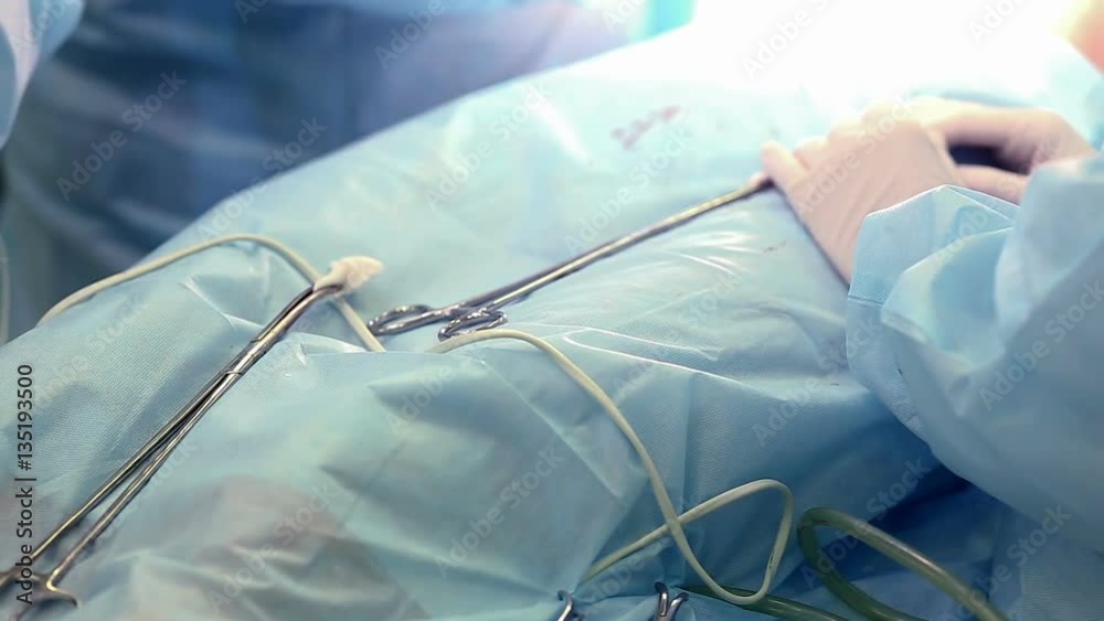 Close-up shot of cosmetic plastic surgery detail, surgical instruments covered in blood. Surgeon doctor performing cosmetic surgery in hospital operating room. Breast augmentation implantation Close-up shot of cosmetic plastic surgery detail, surgical instruments covered in blood. Surgeon doctor performing cosmetic surgery in hospital operating room. Breast augmentation implantation