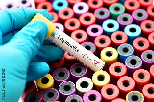 Legionella positive photo