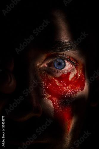 Eye with blood.
