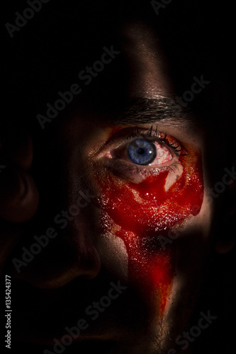 Eye with blood. photo