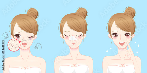 woman with acne problem