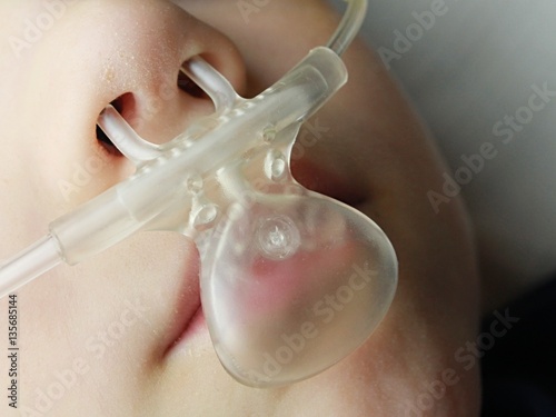 Capnography sidestream line on mouth and nose of pediatric male patient photo