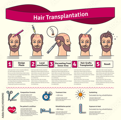 Vector Illustrated set with hair transplant surgery