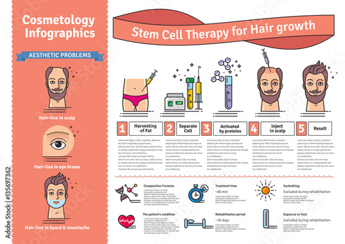 Vector Illustrated set with stem cell therapy for hair growth