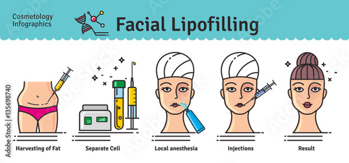 Vector Illustrated set with cosmetology facial lipofilling