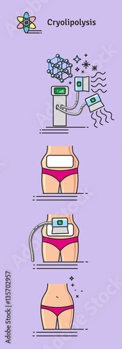 Vector Illustrated set with cosmetology Cryolipolysis treatment