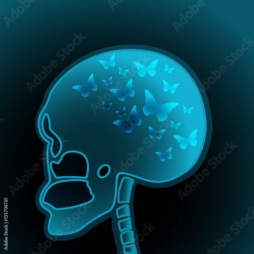 X-ray Vector illustration X-ray of a human skull with butterflies in the head Realistic style