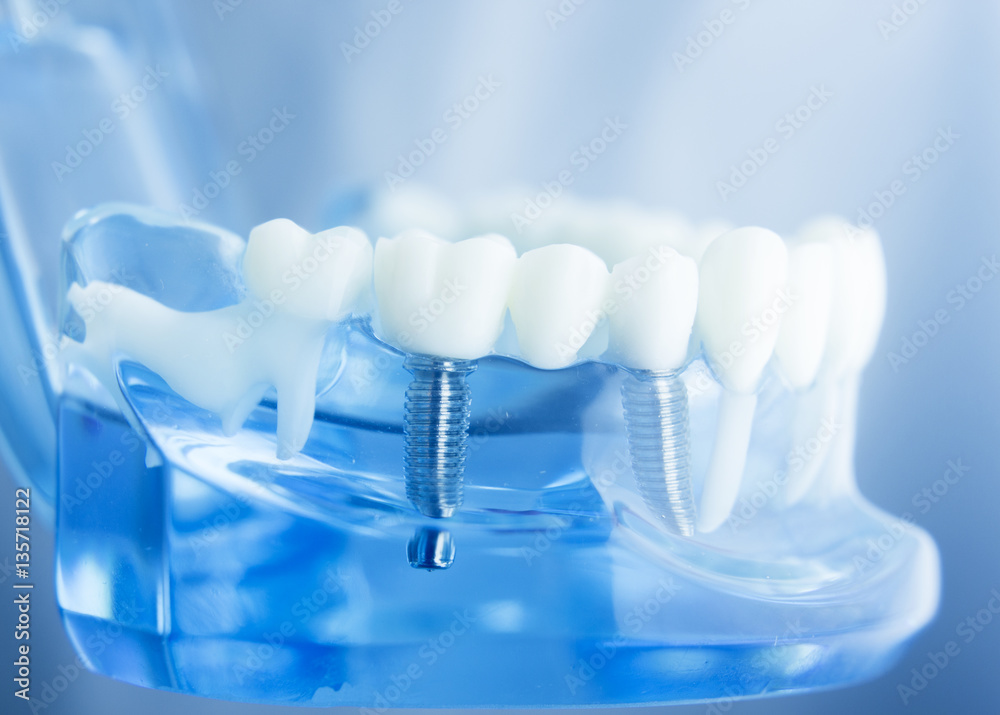 Dental teeth dentistry model Dental teeth dentistry model