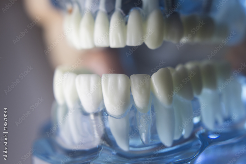 Fototapeta premium Dental teeth dentistry model