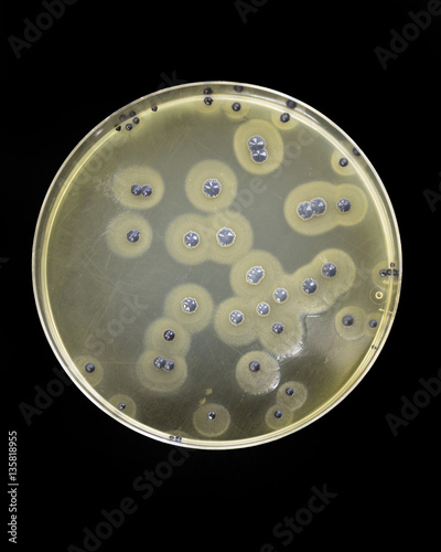 Staphylococcus aureus growing on Baird Parker agar showing black colonies and clearing zones.