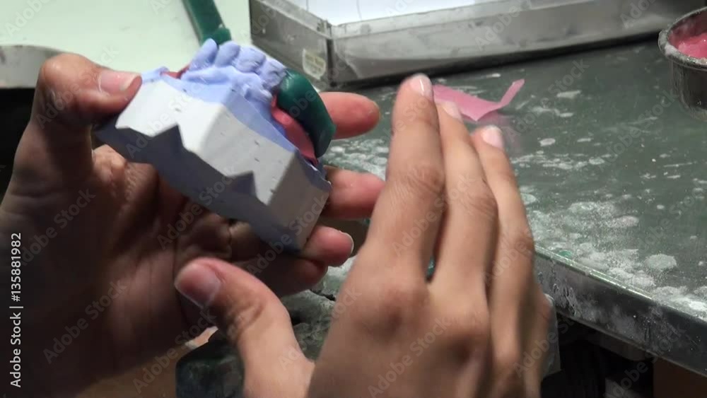 Dentist is applying hot wax into a mold. Dental technologist, the restorations may be formed