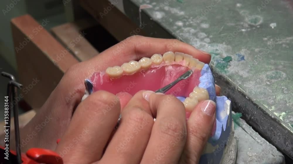 Stockvideon Dentist is applying hot wax into a mold. Dental