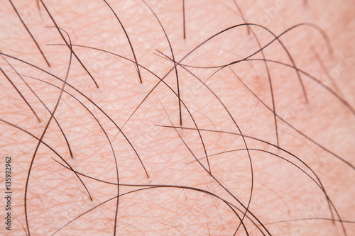 human skin macro texture