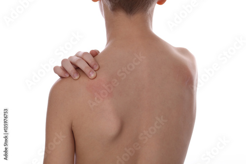 Child Scratching an itch isolated on white background . Sensitive Skin, Allergic Reaction, Irritation