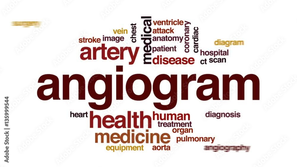Angiogram animated word cloud, text design animation. Angiogram animated word cloud, text design animation.