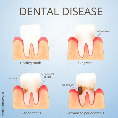 structure of human teeth