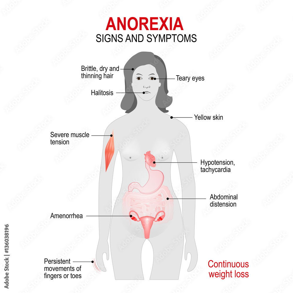 anorexia nervosa vital signs