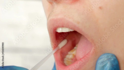 swabbing mouth, taking dna