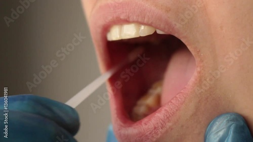 swabbing mouth, taking dna