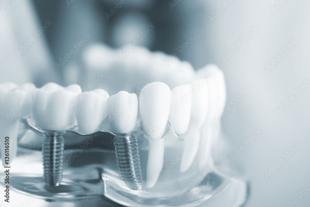 Dental teeth dentistry model Dental teeth dentistry model