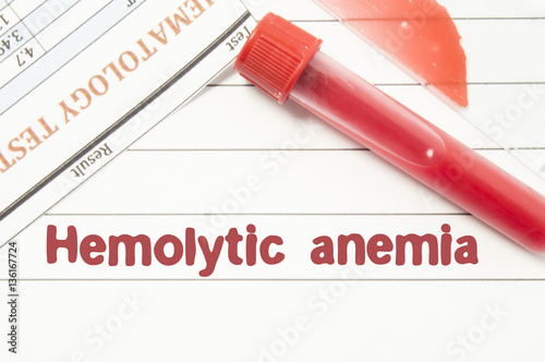 Diagnosis Hemolytic Anemia. Notepad with text labels Hemolytic Anemia, laboratory test tubes for the blood, blood smear for microscopy, and results of laboratory test of blood on table at the doctor photo