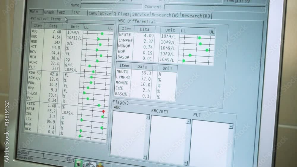 Laboratory analysing of blood. Close-up shot of monitor with results of blood test on it. HD Laboratory analysing of blood. Close-up shot of monitor with results of blood test on it. HD