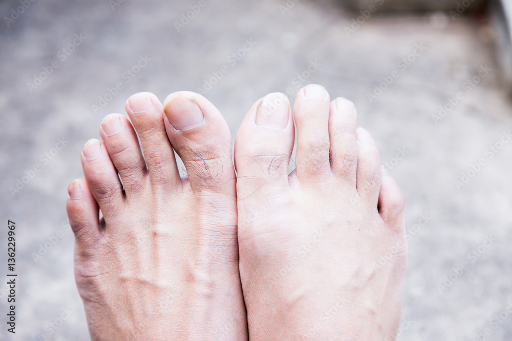 foot old man foot old man
