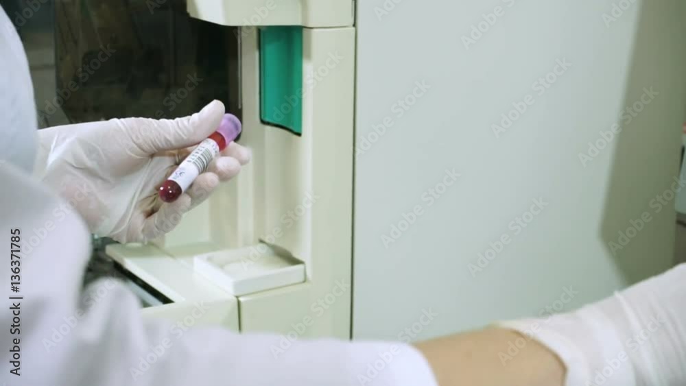 Female scientist analyzing sample of blood on modern equipment at laboratory. HD Female scientist analyzing sample of blood on modern equipment at laboratory. HD