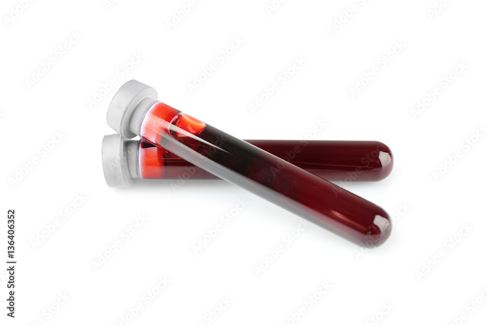 Test tubes with blood samples isolated on white Test tubes with blood samples isolated on white