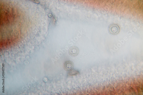 Gills of fish ,protozoa and Trichodina spp. under the microscope.(soft focus and have Grain/Noise ) photo