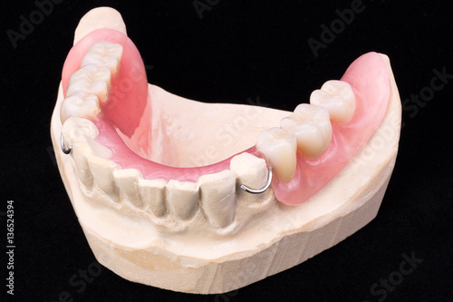 Denture, lower jaw