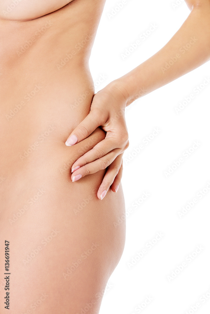 The woman squeezes a skin on a hip for check on a cellulitis.