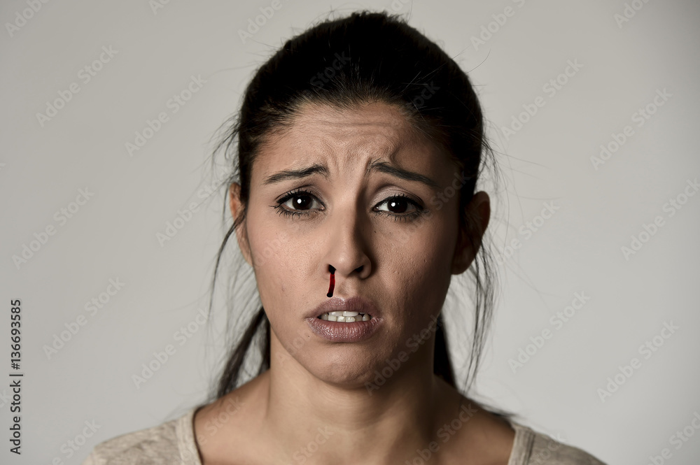 hispanic sad woman victim of serious domestic violence abuse attack