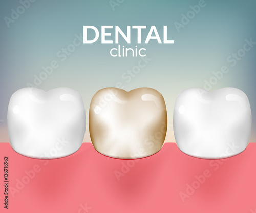 Dental desease clinic concept. Tooth healthcare hygiene. Toothache need dentist