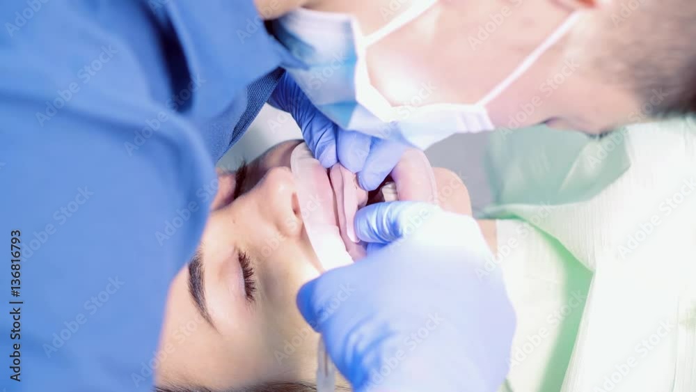 The dentist makes a form for removing the impression from the patient's teeth girl. The doctor makes perfectly straight teeth and a beautiful white smile with the help of veneers. The dentist makes a form for removing the impression from the patient's teeth girl. The doctor makes perfectly straight teeth and a beautiful white smile with the help of veneers.