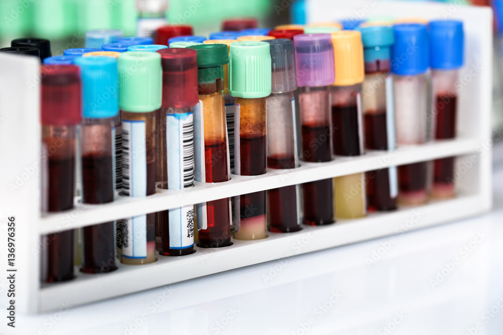 blood tubes samples in tray in the laboratory / table of lab with sample tubes in rack blood tubes samples in tray in the laboratory / table of lab with sample tubes in rack