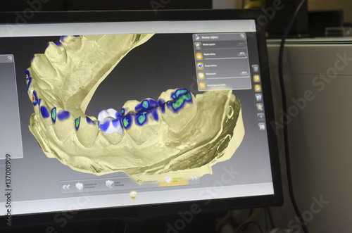 Dental technician is designing a dental crown with a computer.