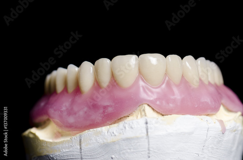 Closeup of dental prosthesis porcelain teeth in a mold