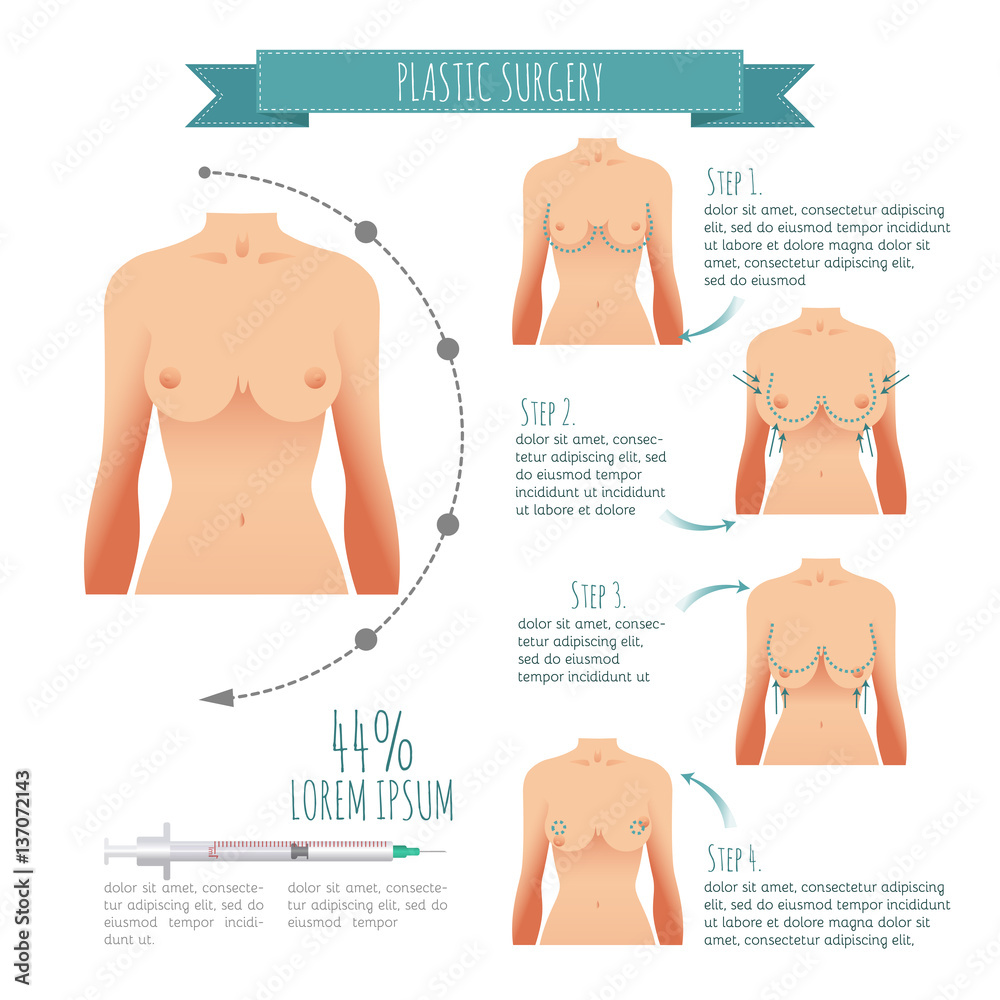 Woman Breast Lift, Vector & Photo (Free Trial)