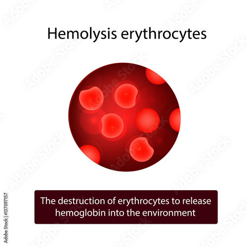 Erythrocytes. Hemolysis of red blood cells. Vector illustration on isolated background