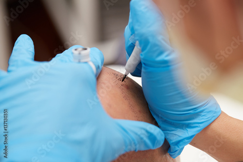 professional tattooist making permanent make up tricopigmentation photo