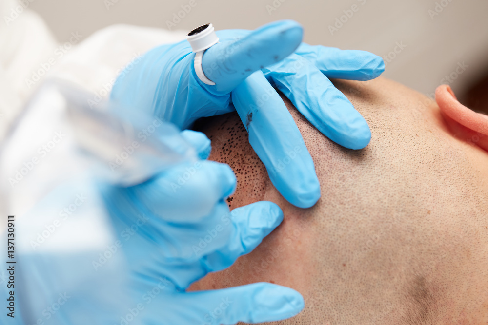 Fototapeta premium professional tattooist making permanent make up tricopigmentation