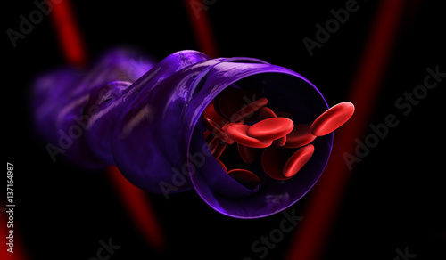 3d Illustration of Varicose vein forms in a leg, isolated black