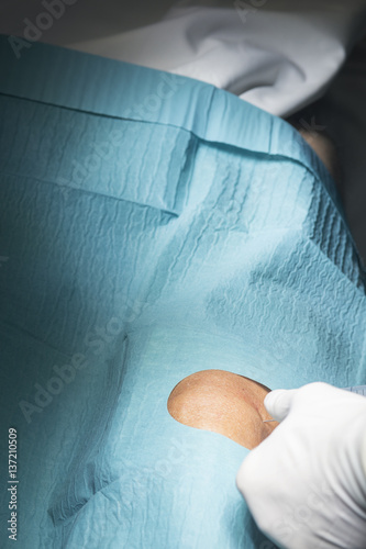Knee surgery surgical operation © edwardolive