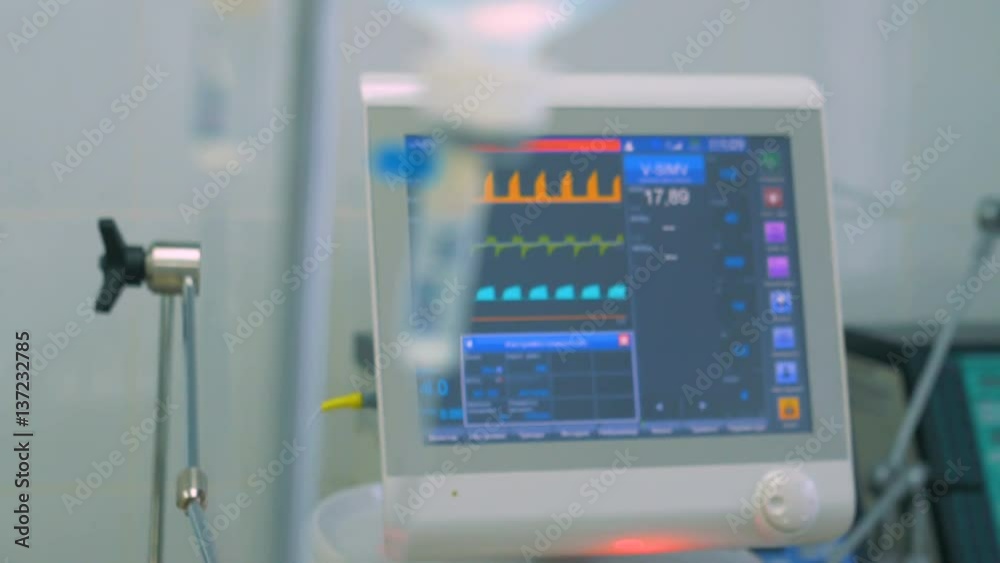 Intravenous drip, medical equipment on background. Surgeons team performing operation. 4K. Intravenous drip, medical equipment on background. Surgeons team performing operation. 4K.