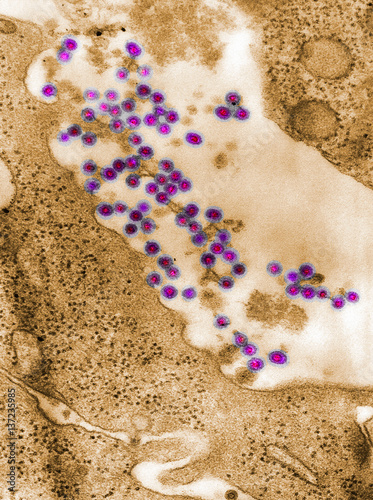 Full frame microscopic image of rubella virus virions in the process of budding from the host cell surface to be freed into the host’s system, producing an enveloped virus particle