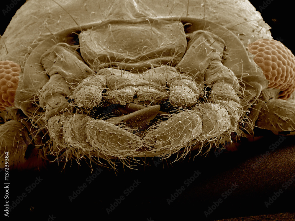 Scanning electron micrograph of the head of an webspinner (Embioptera ...