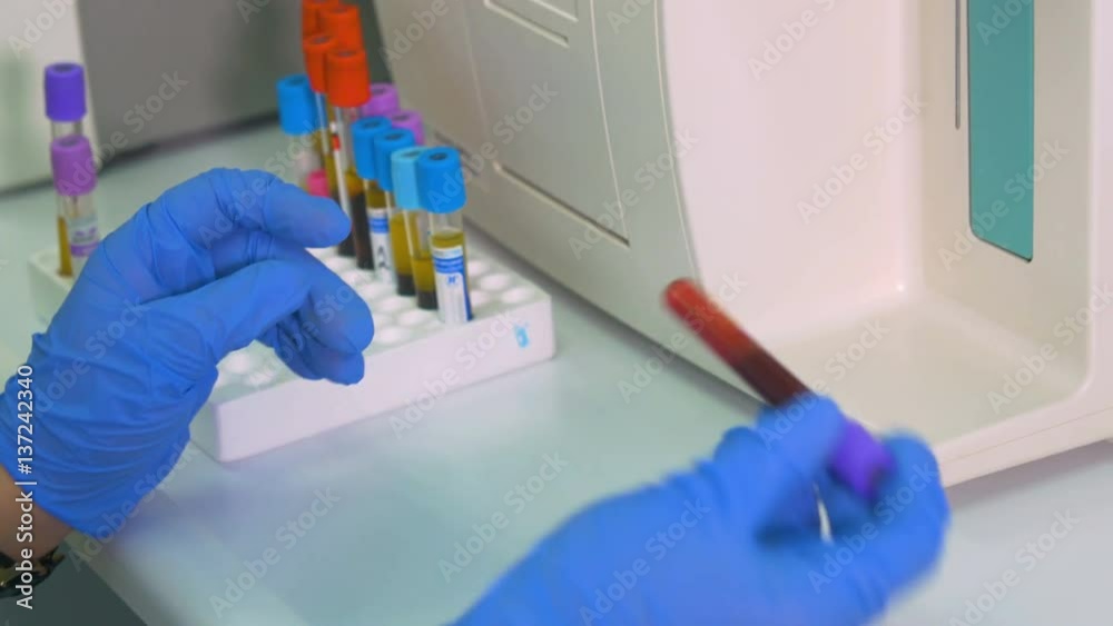 Scientist working with test-tubes in a laboratory. Close-up. 4K. Scientist working with test-tubes in a laboratory. Close-up. 4K.