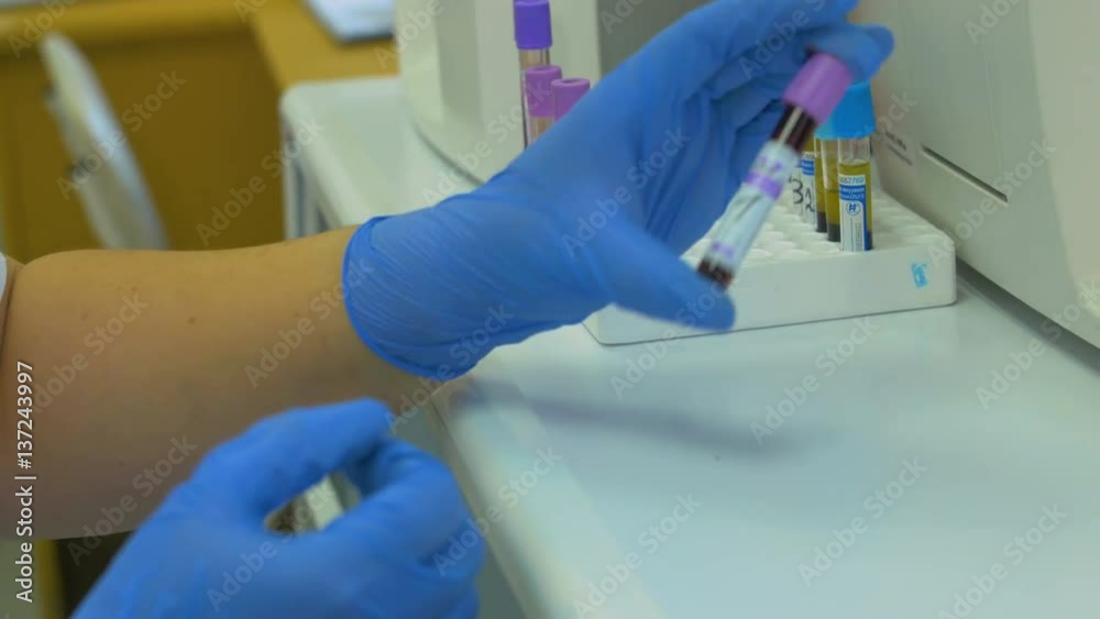Doctor working in the modern medical laboratory. Analysis of blood samples. Research and test of blood in a hospital. 4K. Doctor working in the modern medical laboratory. Analysis of blood samples. Research and test of blood in a hospital. 4K.