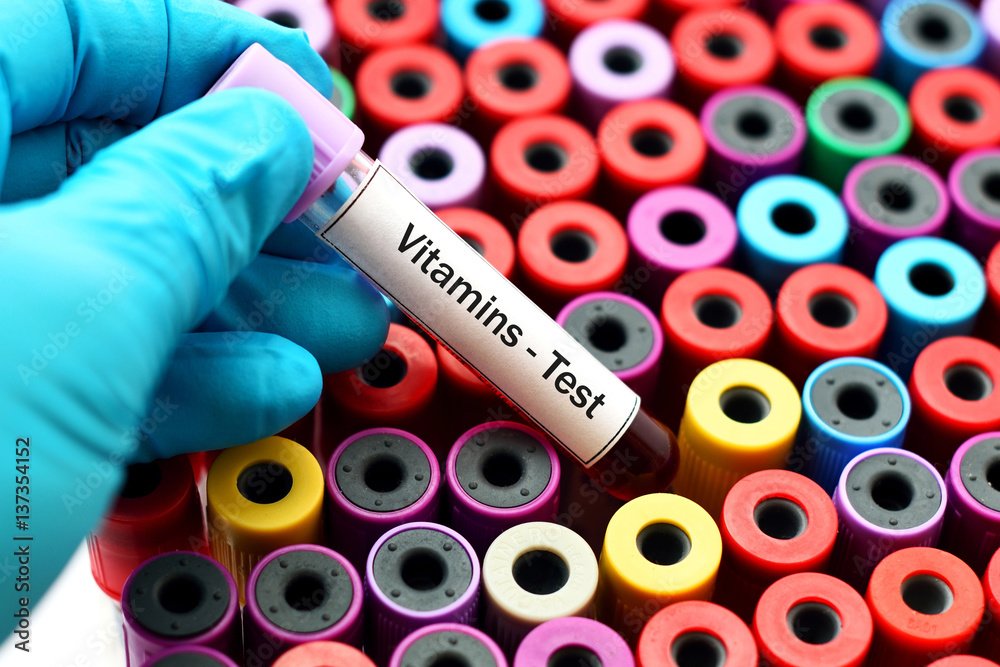 Fototapeta premium Vitamins test